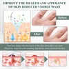 Luhaka Luhaka DermaEase Natureerase Instant Mole Spot Removal Gel,Purifying gel