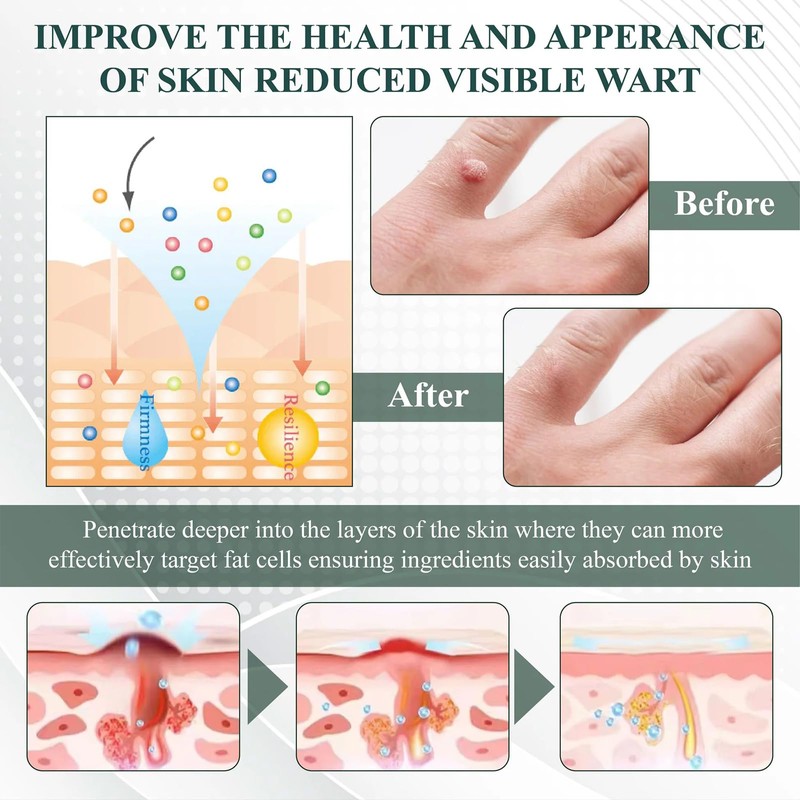 Luhaka Luhaka DermaEase Natureerase Instant Mole Spot Removal Gel,Purifying gel