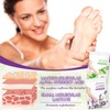 6 Pairs Foot Mask (Aloe Vera + Lavender) with Moisturising