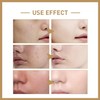 (100% Effective) 2024 New 1/2/3Pcs 𝐑𝐢𝐜𝐞 𝐓𝐨𝐧𝐞𝐫, 𝐌𝐢𝐥𝐤𝐲 𝐓𝐨𝐧𝐞𝐫 𝐟𝐨𝐫