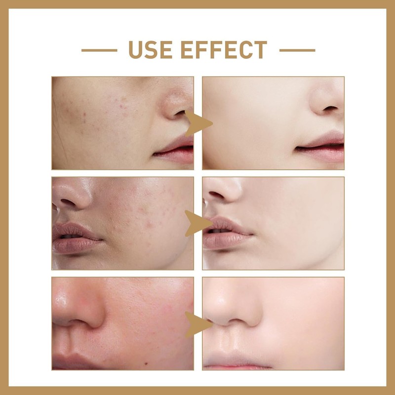 (100% Effective) 2024 New 1/2/3Pcs 𝐑𝐢𝐜𝐞 𝐓𝐨𝐧𝐞𝐫, 𝐌𝐢𝐥𝐤𝐲 𝐓𝐨𝐧𝐞𝐫 𝐟𝐨𝐫