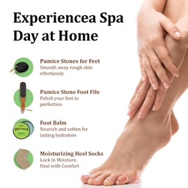 Foot Callus Remover Set 4 Pcs - Pumice Stone - Feet File Scrubber - Foot Balm Rosemary - Moisturizing Heel Socks with Soft Gel Lining - Feet Care Treatment