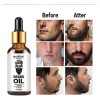 30 Ml Aceite Natural Para El Crecimiento La Barba Los