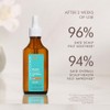 Moroccanoil Tratamiento Cuero Cabelludo Seco, 45 ml