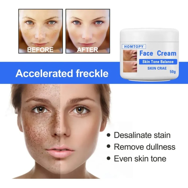 Crema Aclaradora Facial Moteada 50 G, Melasma Speckle Moistu