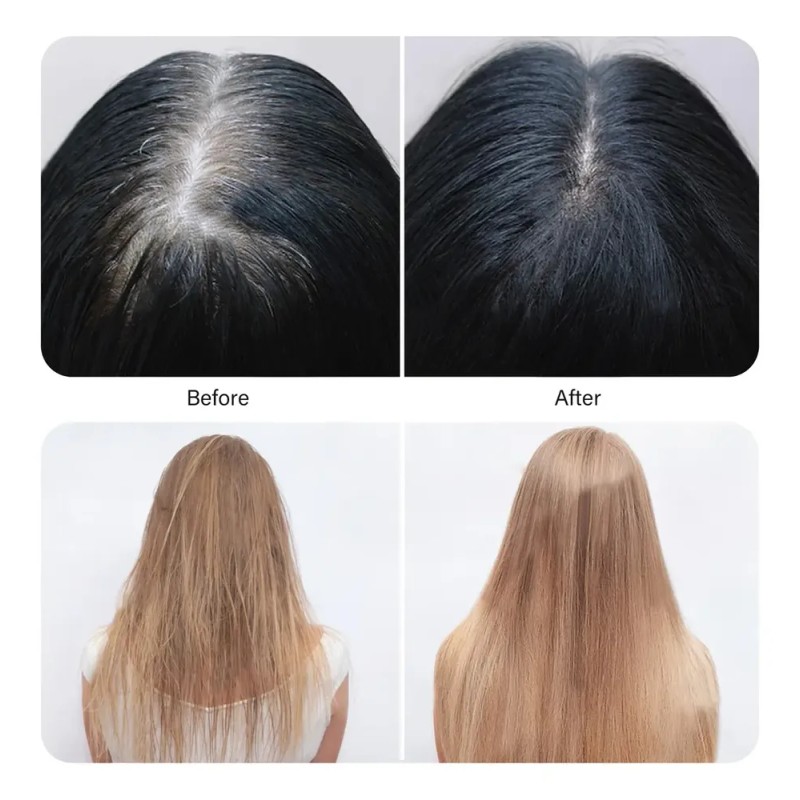 Aceite Para El Crecimiento Del Cabello Belleka Veganic Natur