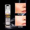 Khangura - Anti Spot Serum, Anti-aging, Anti-wrinkle, Reduce Pigmentation, Dark