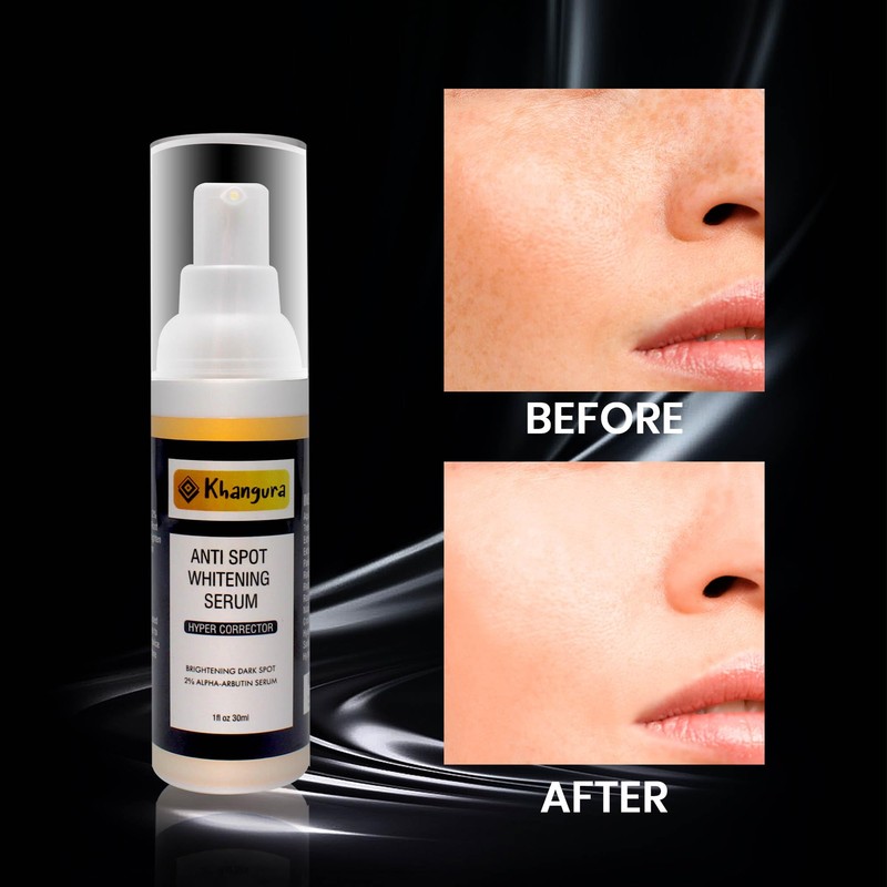 Khangura - Anti Spot Serum, Anti-aging, Anti-wrinkle, Reduce Pigmentation, Dark