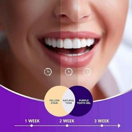 MEOLY Purple Toothpaste for Teeth Whitening - 1 OZ