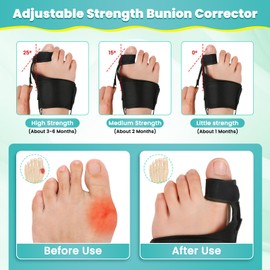 CEYOME Adjustable Bunion Corrector Women & Men, Bunion Splint Brace Big Toe Straightener for Bunion Relief