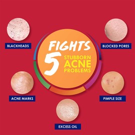 Clearasil Stubborn Acne Control 5in1 Daily Facial Cleansing Pads, 90 Count (Packaging may vary) ( Pack of 6)