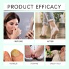  Foot Sanitizer Spray with Tea Tree Oil, Tea Tree