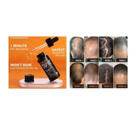 Follicle Hair Growth Treatment, Maximize Anagen Stage To Prolong Hair Growth