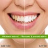 Rembrandt Deeply White + Peroxide Whitening Toothpaste, Peppermint Flavor, 3.5-Ounce