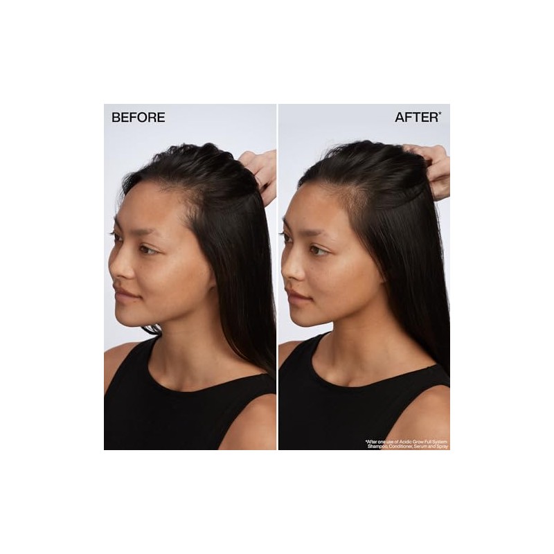 Redken Acidic Grow Full System Sérum de cuero cabelludo &