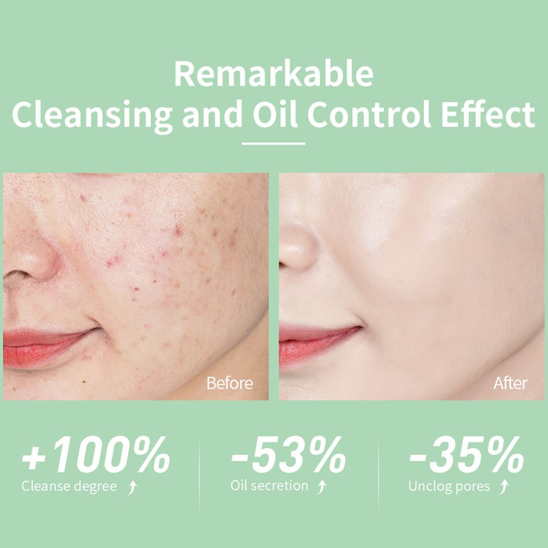 Foaming Facial Cleanser Plant Based Nourishing Face Wash Fine Foaming
