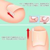 Chisafly Rolling Nail Clips, Rolling Toenails, Foot Coiled Toenails [10