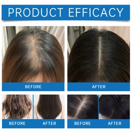 2PCS Scalp Cooling Hair Ampoule, Scalp Serum & Hair Growth Serum for Men & Women – Top-of-Head Protector with Roller, Non-Greasy, Improves Shine & Cleans Surface, 20g