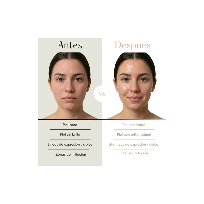 Suero Facial Humectante Vit E + Rosa Mosqueta + Jojoba
