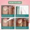 2 Lápices Tratamiento Antihongos Para Uñas