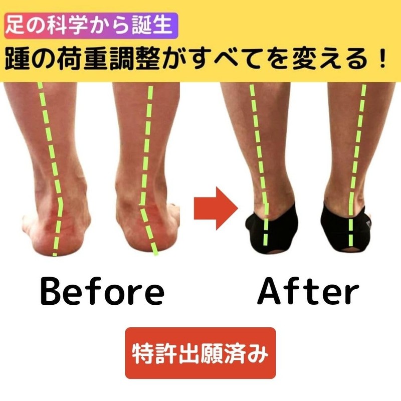 LOPER Foot Kicking Plantar Fasciitis, Heel, Arch Support, Arch Support,
