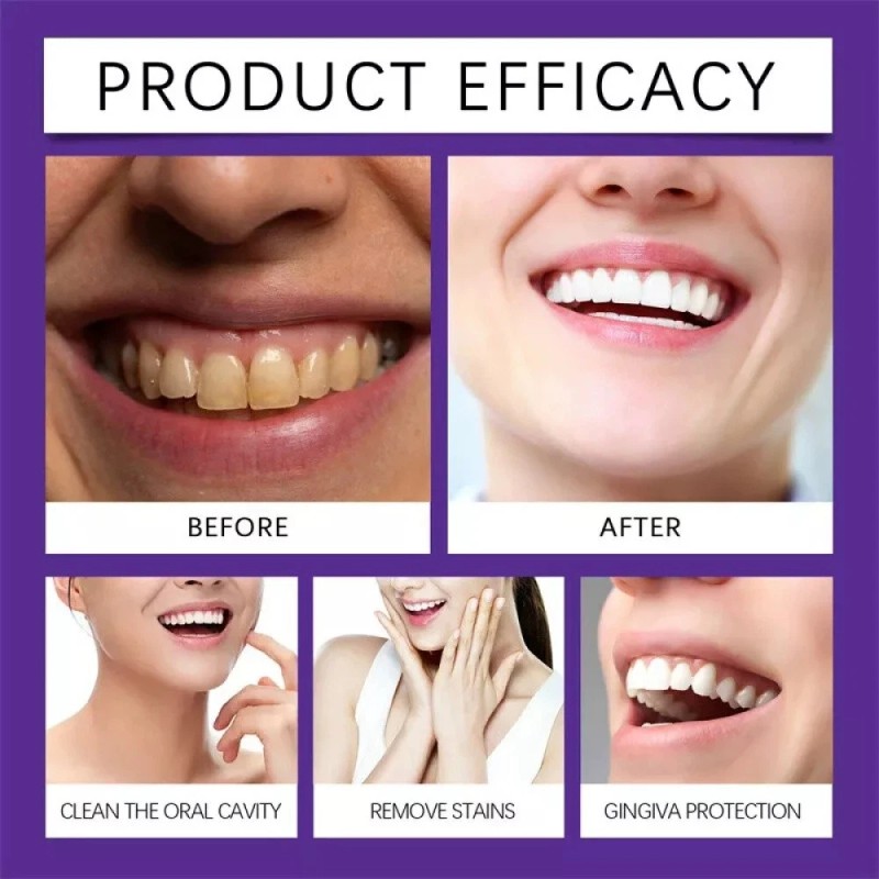 Oralhoe Teeth Whitening Mineral Powder for Tooth Restoration Teeth Whitening