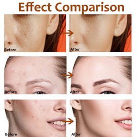 Bluemega Reducir los poros Suero Minimizador de Poros, Suero Minimizador de Poros para la Piel de la Cara, Reduce los Poros, Alivia la Sequedad, Equilibra y Reafirma la Piel, Suero para la Cara Piel Grasa y cualquier tipo de Piel