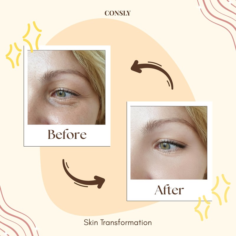 CONSLY 150 Pcs (5 Packs x 30) Marine Collagen &