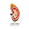 Science Resource S08880 Kidney with Adrenal Gland (Removable) 2X Life