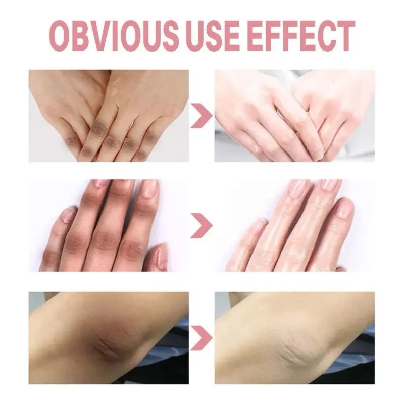 Crema Aclaradora De Axilas Para Mujeres Con Ácido Kójico Par