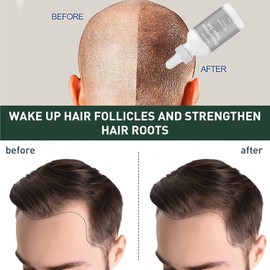 Deoxyribose Sugar Gel Hair Growth, Deoxy Ribose Sugar Hair Growth for Hair Loss