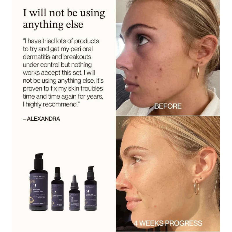 Edible Beauty Starter Skincare Set