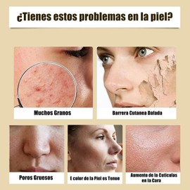 Ácido Glicólico 7% Solución 240ML, Ácido Glicólico 7% Tonifica, Exfolia, Reduce las Marcas del Acné y los Granitos, Rejuvenece la Piel, Un Tónico Facial que lumina tu Cutis.