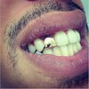 Onwon 2 Pieces 14K Plated Gold Grillz Hip Hop Top