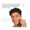 AcneFree Terminator 10 Acne Spot Treatment with Benzoyl Peroxide 10%