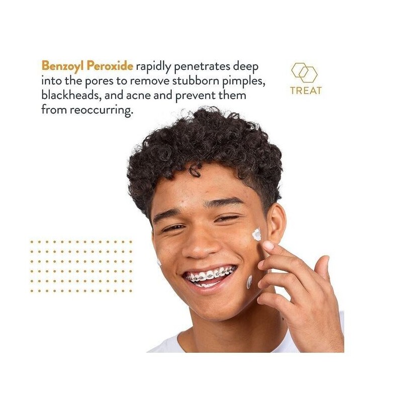 AcneFree Terminator 10 Acne Spot Treatment with Benzoyl Peroxide 10%