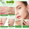 Serum Bioaqua Centella Asiatica Antiacn Control Grasa Todo Tipo De