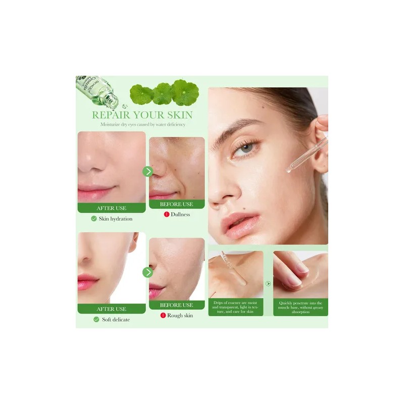 Serum Bioaqua Centella Asiatica Antiacn Control Grasa Todo Tipo De
