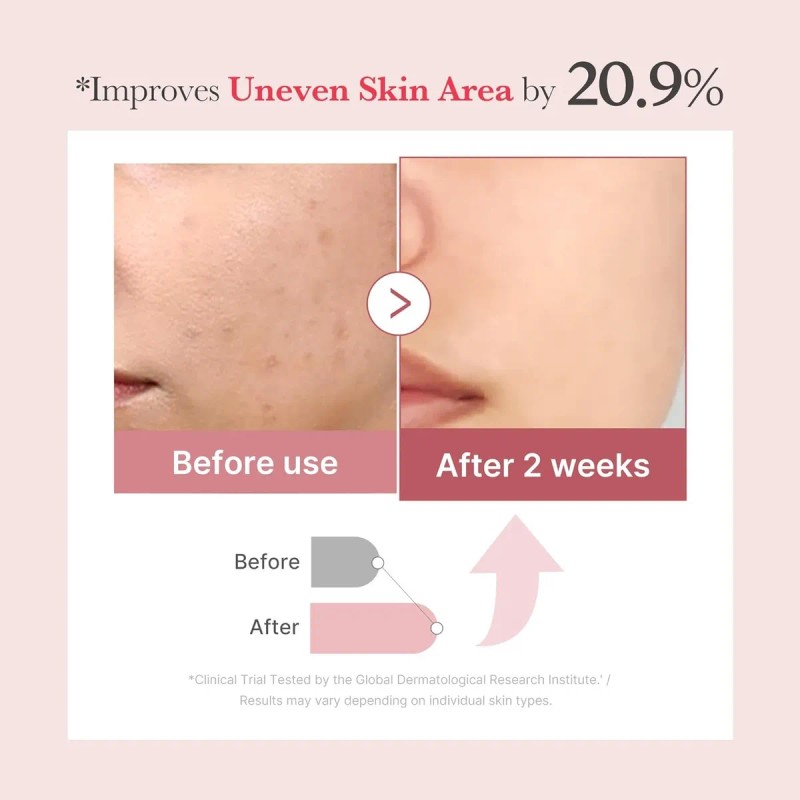 Trn Pink Collagen Exosome Shot 7500 Intensive Matu New