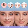 Vigorder Nose Pore Patches, Hydrocolloid Nose Patches, Targets Pimple, Pores