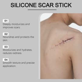 Barra de silicona para cicatrices para rostro y cuerpo – Barra de silicona para el cuidado de cicatrices – Palo de parche suave para marcas para pieles sensibles, marcas de acné gel (8 cajas)