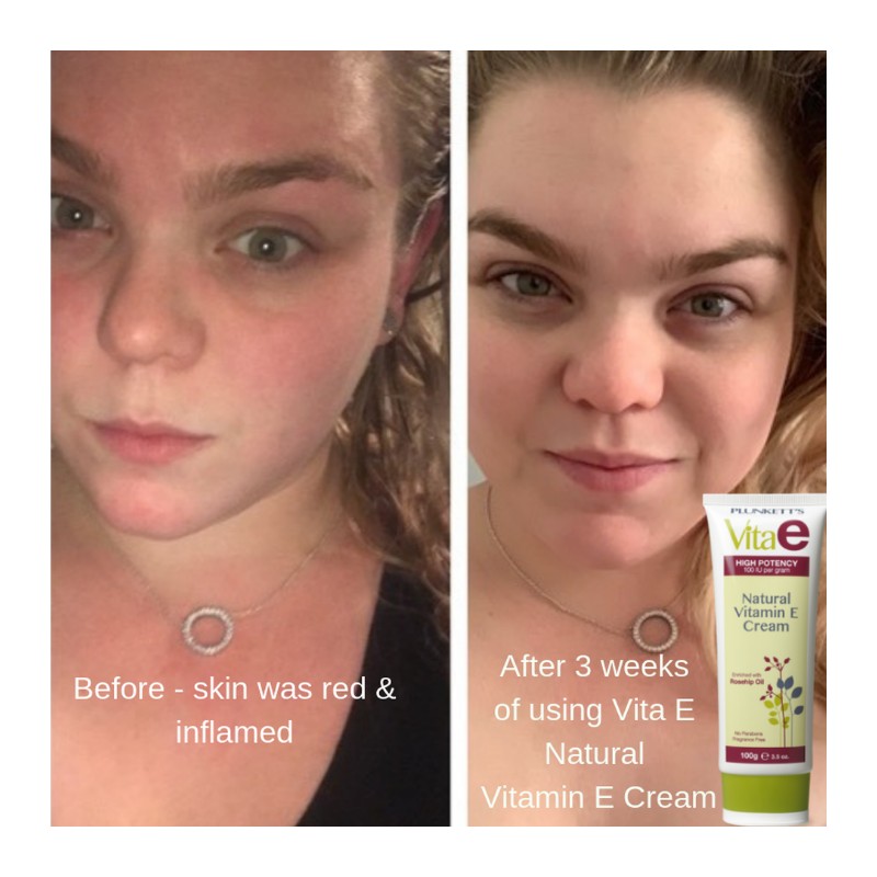 Plunkett's Vita E Natural Vitamin E Cream 100g