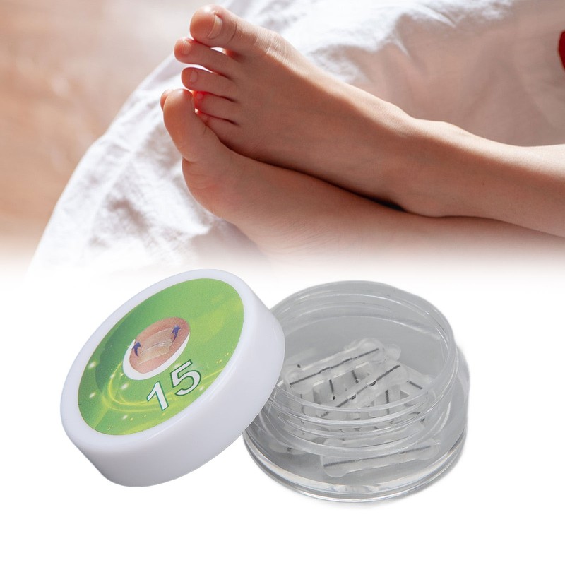 10pcs Toenail Correction Strips Brace Elastic Change Growth Direction Ingrown