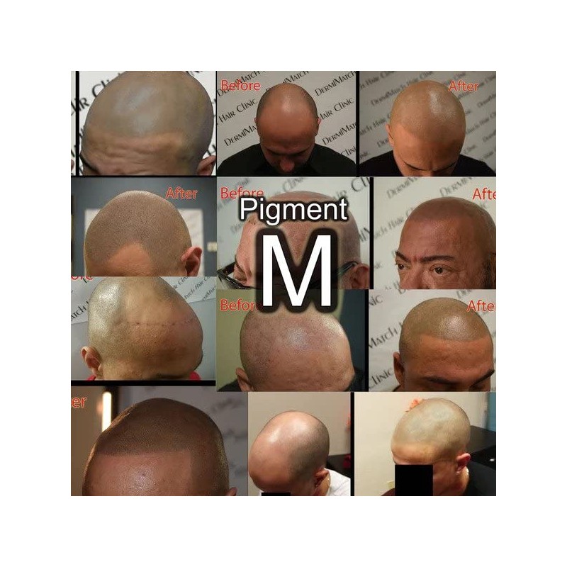 3-Pack - All SMP Scalp pigments - Half Oz