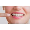 GUM Cera Para Brackets / Ortodoncia Gum® + Vitamina E