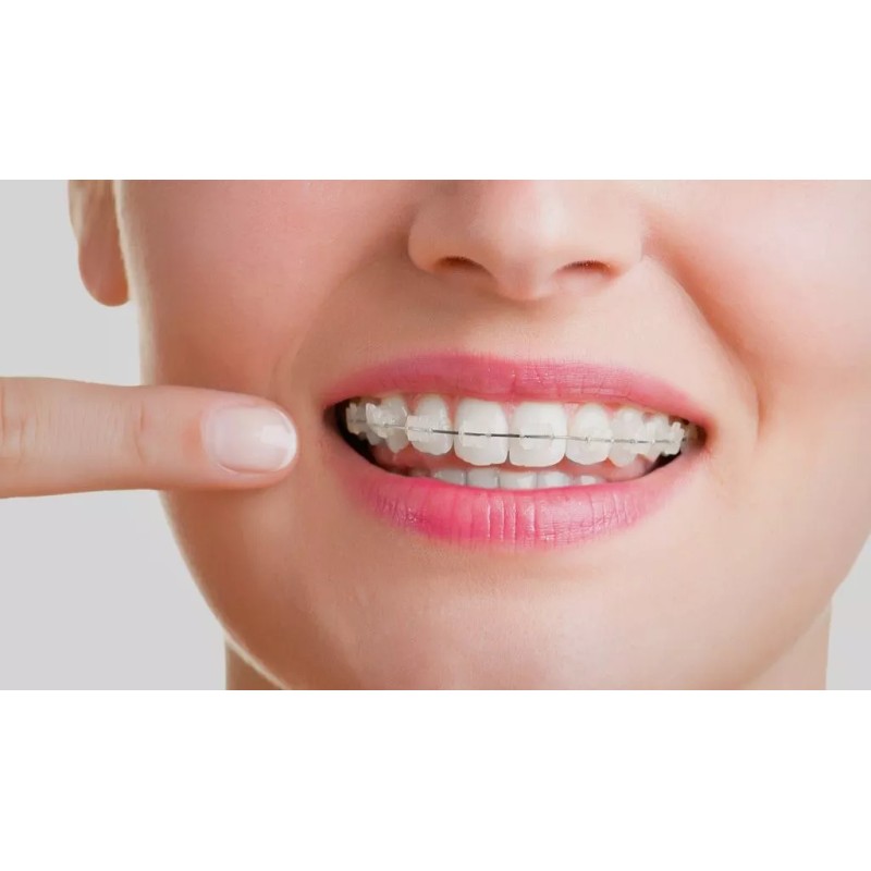 GUM Cera Para Brackets / Ortodoncia Gum® + Vitamina E