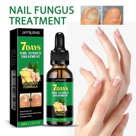 Ginger nail care, nail support, care, nourishment, vitamin E + plant essential oils, strong and healthy nails, multi-functional nail repair, suitable for nail care for discolored and damaged nails - Specification: 2count