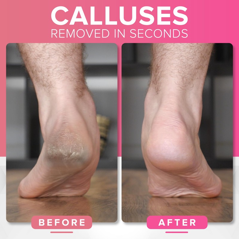 Stainless Steel Professional Pedicure Foot File - (XL Size) Pedicure