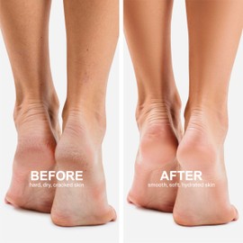 Innerest Original Derma Beauty Foot Mask 24 Pairs Detoxifying Charcoal Moisturizing Foot Mask Set Body Exfoliator Callus Remover Foot Masks Foot Bath Pedicure Supplies for Beauty & Personal Care