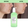 Maruderm Salicylic Acid Face Wash Gel Especially for Combination and